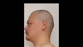 0.5mm坊主から180日後… | Hair Growth Time-lapse - 6 month #buzzcut #坊主