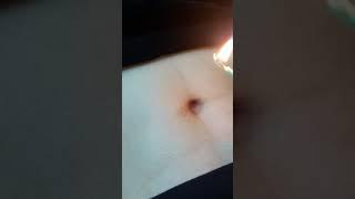 belly button candle torture
