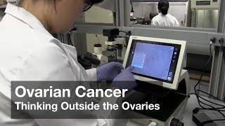 Ovarian Cancer - Thinking Outside the Ovaries