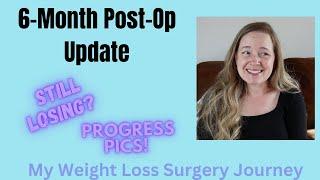 6 Month Post Op with Progress Pics! Gastric Bypass/RNY/Bariatric Surgery Update