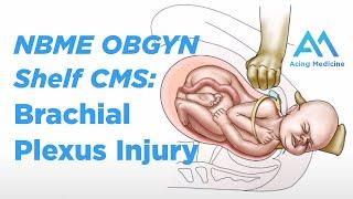 NBME OB/GYN Shelf CMS: Brachial Plexus Injury, Fetal Macrosomia & More | Acing Medicine