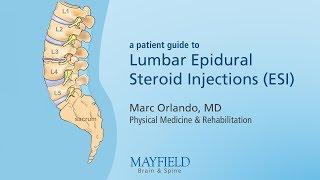 Lumbar Epidural Steroid Injections