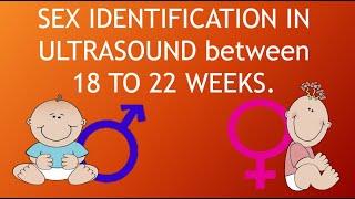 BABY GENDER IDENTIFICATION IN ULTRASOUND | ANOMALY SCAN FOR BOY OR GIRL | fetus | ULTRASOUND STUDY