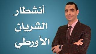 انشطار الشريان الاورطي- دكتور احمد الوكيل إستشاري جراحة القلب والصدر
