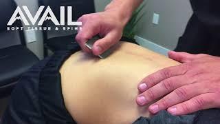 Back Pain Treatment video | Avail Soft Tissue & Spine | Colorado