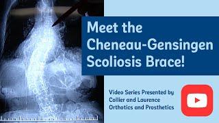 The Cheneau-Gensingen scoliosis brace – A smaller, lighter solution for curve correction.