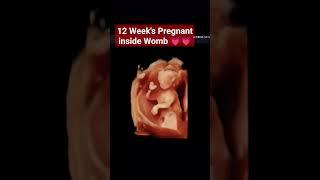 12 Week's Pregnant 5d ultrasound #babyultrasound #pregnancy