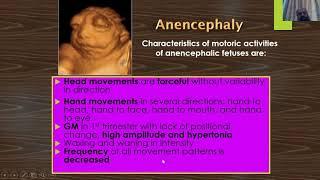 Fetal Anomalies