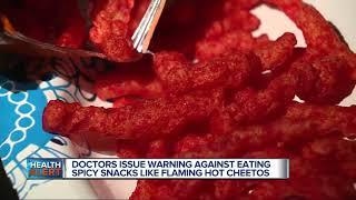 Doctors issue warning against eating spicy snacks like Flaming Hot Cheetos