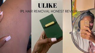 IPL AT HOME LASER HAIR REMOVAL | Final Review