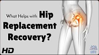 Hip Replacement Recovery: Do This, Not That!