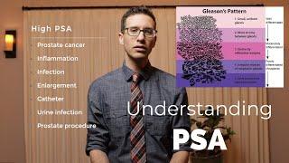 What PSA is and why it's important explained by urologist