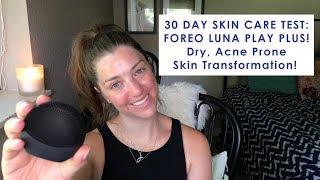 30 DAY SKIN CARE TEST: FOREO LUNA PLAY PLUS! Dry, Acne Prone Skin Transformation!