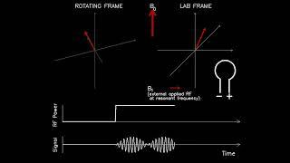 MRI: Physics and Image Creation - Introduction to Spin Flip (Part 2/18)