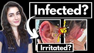 Doctor explains: Is your piercing infected? How to care for a new cartilage piercing