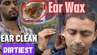 Dirtiest Ear Wax found During Ear Cleaning at Street Side Ear Cleaner | ASMR