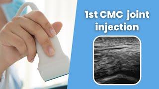 1st CMC  joint injection - MSKUS - Ultrasound guided 1st CMC  joint injection - 2 minute series