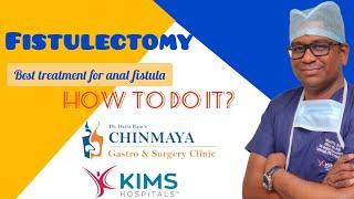 Fistulectomy, Anal fistula surgery, Best treatment