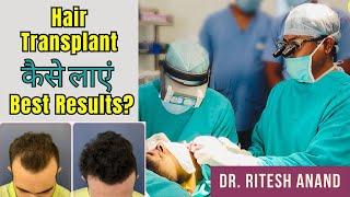 कैसे बनाएं Hair Transplant Surgery को Successful? | Best Hair transplant surgeon in Delhi NCR