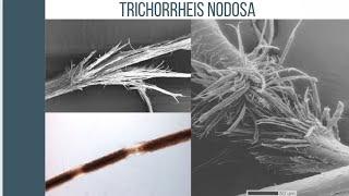 TRICHORRHEIS NODOSA! LET’S TALK HAIRSHAFT DISORDERS CAUSED BY TEAM NATURAL! NO LEAVE IN CONDITIONER!