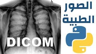 DICOM الصور الرقمية الطبية والتعامل معها باستخدام بايثون