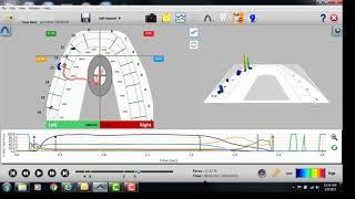 Reviewing Excursion with T-Scan