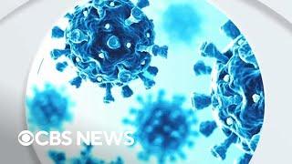 What to know about norovirus as cases surge across U.S.