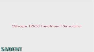 3Shape TRIOS Treatment Simulator greek subtitles