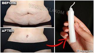 With one candle, your belly fat will melt in one day without diet and exercises