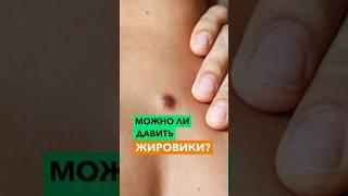 Можно ли давить жировики?