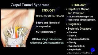 CARPAL TUNNEL SYNDROME 4TH YR