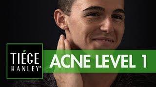 Tiege Hanley Acne System Level 1 | Tiege.com