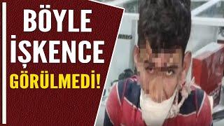 BÖYLE İŞKENCE GÖRÜLMEDİ!