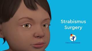 What is Strabismus Surgery?