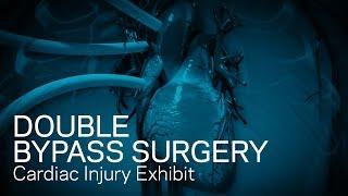 Double Bypass Surgery - Cardiac Injury Exhibit