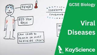 Viral Diseases Explained - GCSE Biology | kayscience.com