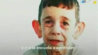 Mohammed Abdelmajeed: tiene siete años, padece progeria y luce como un adulto mayor