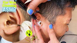 ASMR Worlds’s Greatest Ear Cleaning,Professional Ear Cleaning (whispering)