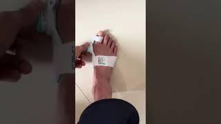 Flexible Bunion Corrector