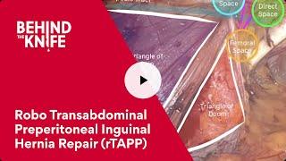 Behind the Knife - Robo Transabdominal Preperitoneal Inguinal Hernia Repair (rTAPP)