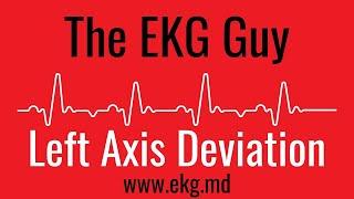 Left Axis Deviation on EKG / ECG l The EKG Guy - www.ekg.md