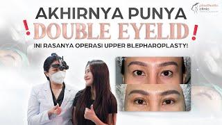 GINI RASANYA OPERASI LIPATAN KELOPAK MATA UPPER BLEPHAROPLASTY | RECOVERY CEPAT