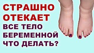 Почему врачи не лечат отечность у беременных на позднем сроке? Как избавиться от отеков беременным?