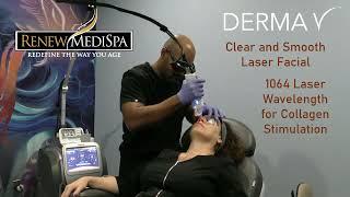 DermaV Clear and Smooth at Renew MediSpa