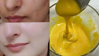 100% Challenge To Get Fair Skin in Just 1 Night / Get Glowing Spotless Bright Skin