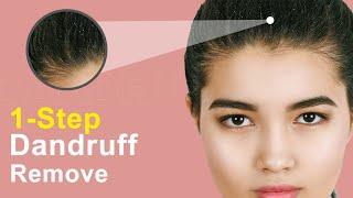 How to remove dandruff from hairs in photoshop (Single-Step Process) #photoshoptutorialforbeginners