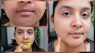 How to Remove Hyperpigmentation & Dark Spots Naturally at Home|Sheetal Verma