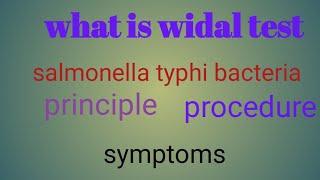 widal test procedure / qualitative and quantitative