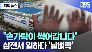 [자막뉴스] "손가락이 썩어갑니다" 삼전서 일하다 '날벼락' (MBC뉴스)