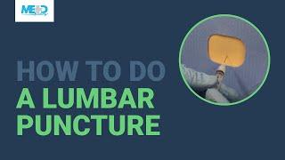 How to do a lumbar puncture